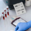Blood collection tube label with custom printing